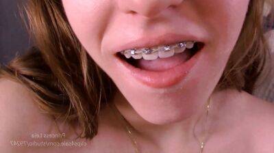 Blow it on my braces - sunporno.com